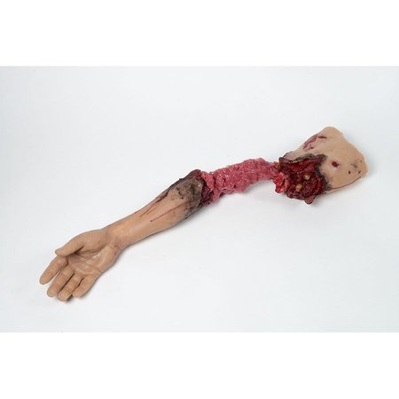 MOULAGE SCIENCE & TRAINING Partial Arm Amputation, Left, Mannequin MST-31-01-L01